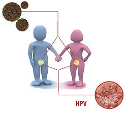 HPV 1